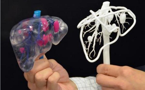 3D打印为医疗器械个性化定制提供保障
